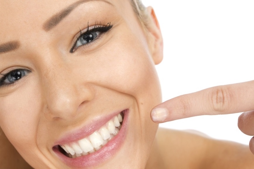 I vantaggi di sbiancare i denti dal dentista 